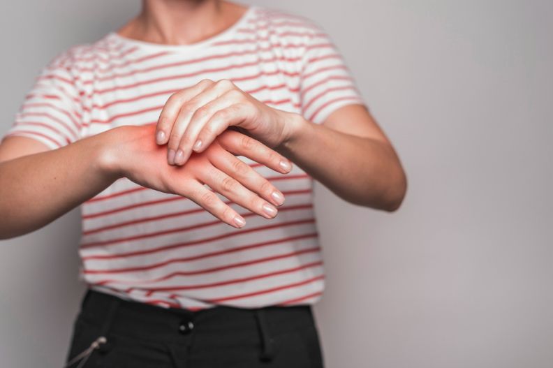 mujer tocándose la mano por el dolor que tiene