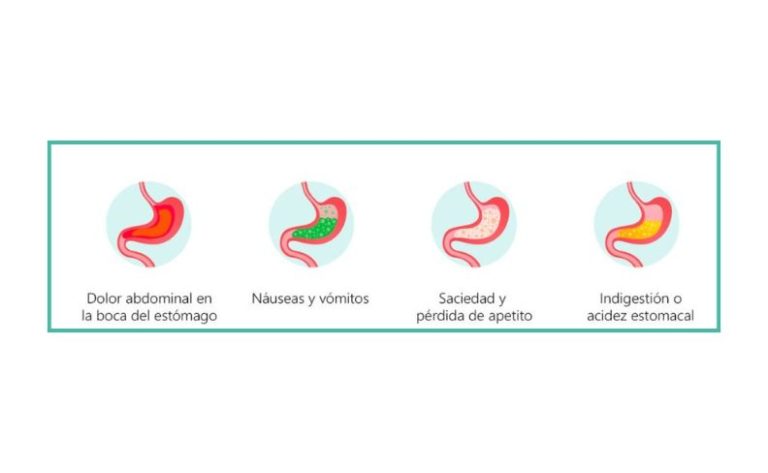 sintomas de la gastritis
